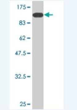 GLMN Antibody (2B5), Novus Biologicals 0.1 mg | Buy Online | Novus Biologicals | Fisher Scientific