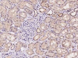 GLMN Antibody, Novus Biologicals 50 &mu;g, Unconjugated:Antibodies, Polyclonal