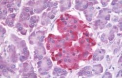 GLP-1R Antibody, Novus Biologicals 50 &mu;g; Unconjugated:Antibodies, Polyclonal