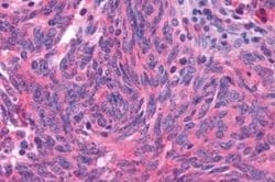 GLP-1R Antibody, Novus Biologicals 50 &mu;g; Unconjugated:Antibodies, Polyclonal