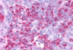 GLP-1R Antibody, Novus Biologicals 50 &mu;g; Unconjugated:Antibodies, Polyclonal