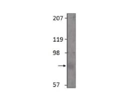 GLP-2R Antibody, Novus Biologicals 100 &mu;g | Buy Online | Bio-Techne | Fisher Scientific