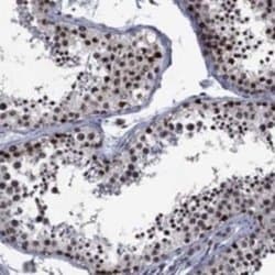 GLP/EHMT1 Rabbit anti-Human, Polyclonal, Novus Biologicals:Antibodies:Primary