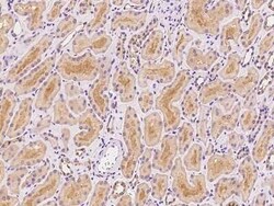 GLRB Antibody, Novus Biologicals 100 &mu;g | Buy Online | Novus Biologicals | Fisher Scientific