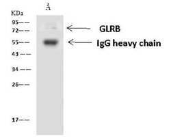 GLRB Antibody, Novus Biologicals 100 &mu;g | Buy Online | Novus Biologicals | Fisher Scientific