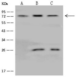 GLRB Antibody, Novus Biologicals 100 &mu;g | Buy Online | Novus Biologicals | Fisher Scientific
