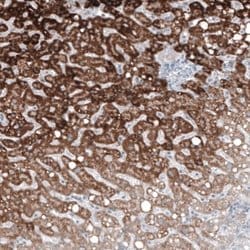 GLS2 Antibody (CL7716), Novus Biologicals 100 &mu;L; Unconjugated:Antibodies,