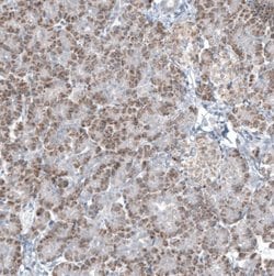GLS2 Antibody (CL7716), Novus Biologicals 100 &mu;L; Unconjugated:Antibodies,