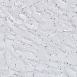 GLS2 Antibody (CL7716), Novus Biologicals 100 &mu;L; Unconjugated:Antibodies,