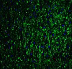 GLS2 Antibody - BSA Free, Novus Biologicals 0.1 mg; Unconjugated:Antibodies,