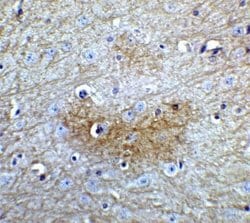 GLS2 Antibody - BSA Free, Novus Biologicals 0.1 mg; Unconjugated:Antibodies,