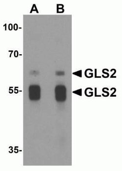 GLS2 Antibody - BSA Free, Novus Biologicals 0.1 mg; Unconjugated:Antibodies,