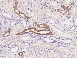 GLUT10 Antibody, Novus Biologicals 50 &mu;g, Unconjugated:Antibodies, Polyclonal