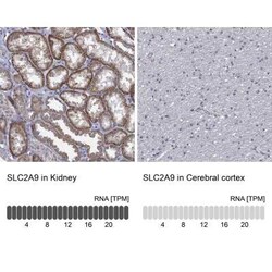 GLUT9 Rabbit anti-Human, Polyclonal, Novus Biologicals:Antibodies:Primary