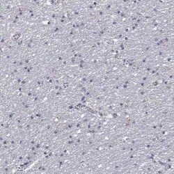 GLUT9 Rabbit anti-Human, Polyclonal, Novus Biologicals:Antibodies:Primary