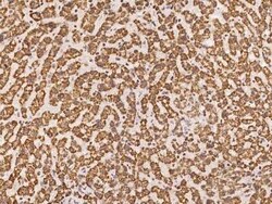 GLYATL1 Antibody, Novus Biologicals 50 &mu;g | Buy Online | Novus Biologicals | Fisher Scientific