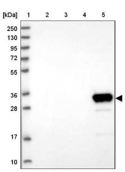 GLYATL1 Antibody, Novus Biologicals 0.1 mL, Unconjugated:Antibodies, Polyclonal