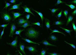 GLYCTK Antibody, Novus Biologicals:Antibodies:Primary Antibodies