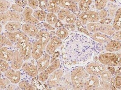 GLYCTK Antibody, Novus Biologicals:Antibodies:Primary Antibodies