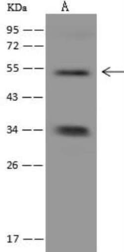 GLYCTK Antibody, Novus Biologicals:Antibodies:Primary Antibodies