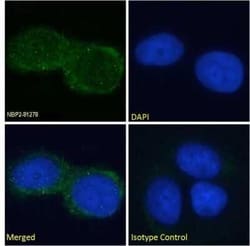 GM2 Ganglioside Antibody (L55-81) - Chimeric - Azide and BSA Free, Novus