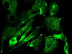 GM2A Antibody, Novus Biologicals 50 &mu;g; Unconjugated:Antibodies, Polyclonal