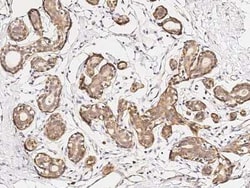 GM2A Antibody, Novus Biologicals 50 &mu;g; Unconjugated:Antibodies, Polyclonal