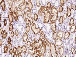 GM2A Antibody, Novus Biologicals 100 &mu;g; Unconjugated:Antibodies, Polyclonal