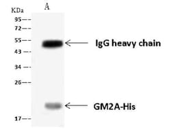 GM2A Antibody, Novus Biologicals 100 &mu;g; Unconjugated:Antibodies, Polyclonal