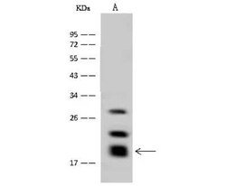 GM2A Antibody, Novus Biologicals 100 &mu;g; Unconjugated:Antibodies, Polyclonal