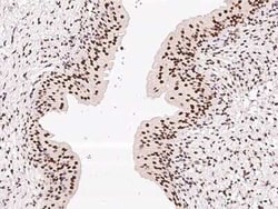 GM632 Antibody, Novus Biologicals 100 &mu;g, Unconjugated:Antibodies, Polyclonal