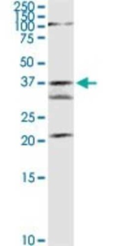 GMDS Antibody, Novus Biologicals 0.1 mg | Buy Online | Novus Biologicals | Fisher Scientific