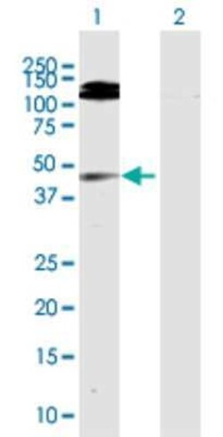 GMDS Antibody, Novus Biologicals 0.1 mg | Buy Online | Novus Biologicals | Fisher Scientific