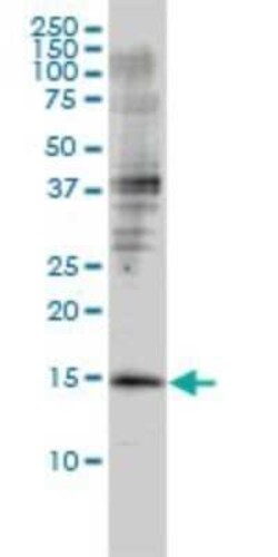 GMF-beta Antibody (2G12-2A2), Novus Biologicals 0.1 mg | Buy Online | Novus Biologicals | Fisher Scientific