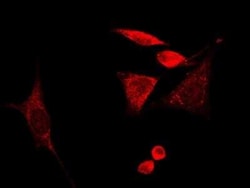 GMF-beta Antibody, Novus Biologicals 100 &mu;g, Unconjugated:Antibodies,