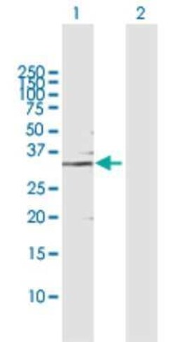 GMPR1 Antibody, Novus Biologicals 0.1 mg | Buy Online | Novus Biologicals | Fisher Scientific