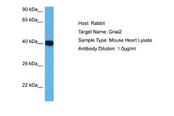 GNAI3 Rabbit anti-Human, Mouse, Polyclonal, Novus Biologicals 0.1 mL | Buy Online | Novus Biologicals | Fisher Scientific