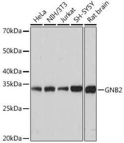GNB2 Rabbit anti-Human, Mouse, Rat, Clone: 6U9B3, Novus Biologicals 100 &mu;g | Buy Online | Novus Biologicals | Fisher Scientific