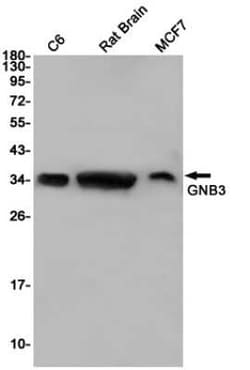 GNB3 Rabbit anti-Human, Mouse, Rat, Clone: S01-9F3, Novus Biologicals 100 &mu;g | Buy Online | Bio-Techne | Fisher Scientific