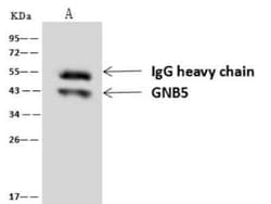 GNB5 Antibody, Novus Biologicals 100 &mu;g | Buy Online | Novus Biologicals | Fisher Scientific