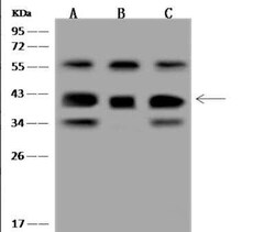 GNB5 Antibody, Novus Biologicals 100 &mu;g | Buy Online | Novus Biologicals | Fisher Scientific