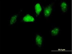 GNL1 Antibody, Novus Biologicals 0.05 mg | Buy Online | Novus Biologicals | Fisher Scientific