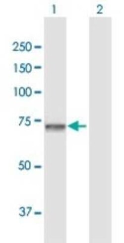 GNPAT Antibody, Novus Biologicals 0.1 mg; Unconjugated:Antibodies, Polyclonal