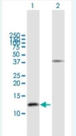 GNRH2 Antibody, Novus Biologicals 50 &mu;g | Buy Online | Novus Biologicals | Fisher Scientific