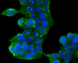 GOLM1 Rabbit anti-Human, Clone: JA63-03, Novus Biologicals 100&mu;L:Antibodies,
