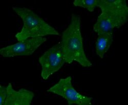 GOLM1 Rabbit anti-Human, Clone: JA63-03, Novus Biologicals 100&mu;L:Antibodies,