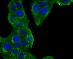 GOLM1 Rabbit anti-Human, Clone: JA63-03, Novus Biologicals 100&mu;L:Antibodies,