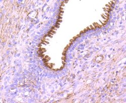 GOLM1 Rabbit anti-Human, Clone: JA63-03, Novus Biologicals 100&mu;L:Antibodies,
