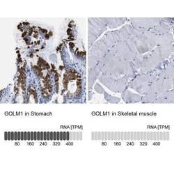 GOLM1 Antibody, Novus Biologicals 25 &mu;L; Unconjugated:Antibodies, Polyclonal