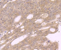 GOLPH3 Rabbit anti-Human, Mouse, Rat, Polyclonal, Novus Biologicals 100